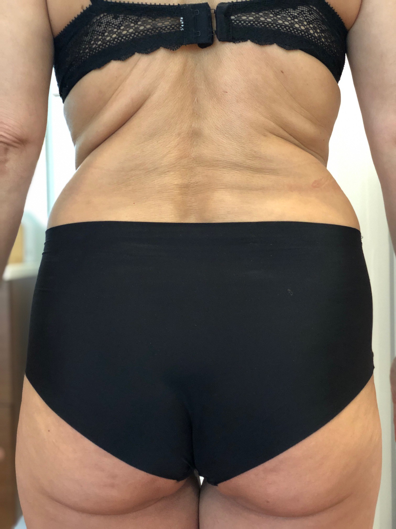 Rücken nach 1 bodydetox