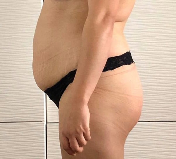 bauch 2