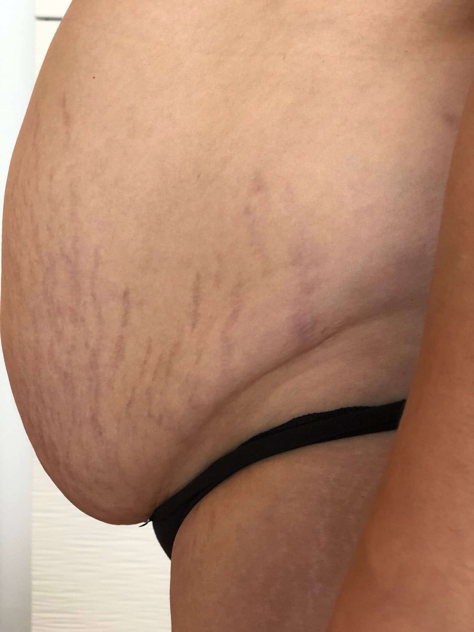 bauch