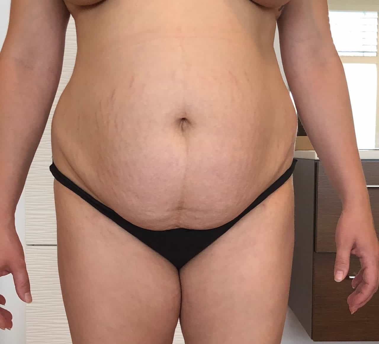 bauch3